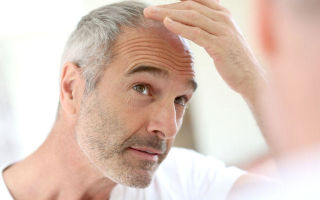 Как избавиться от псориаза волосистой части головы?