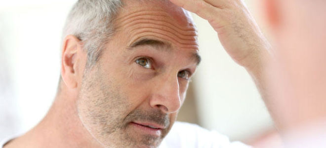 Как избавиться от псориаза волосистой части головы?